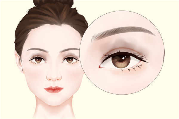不整容怎样使眼睛变大?