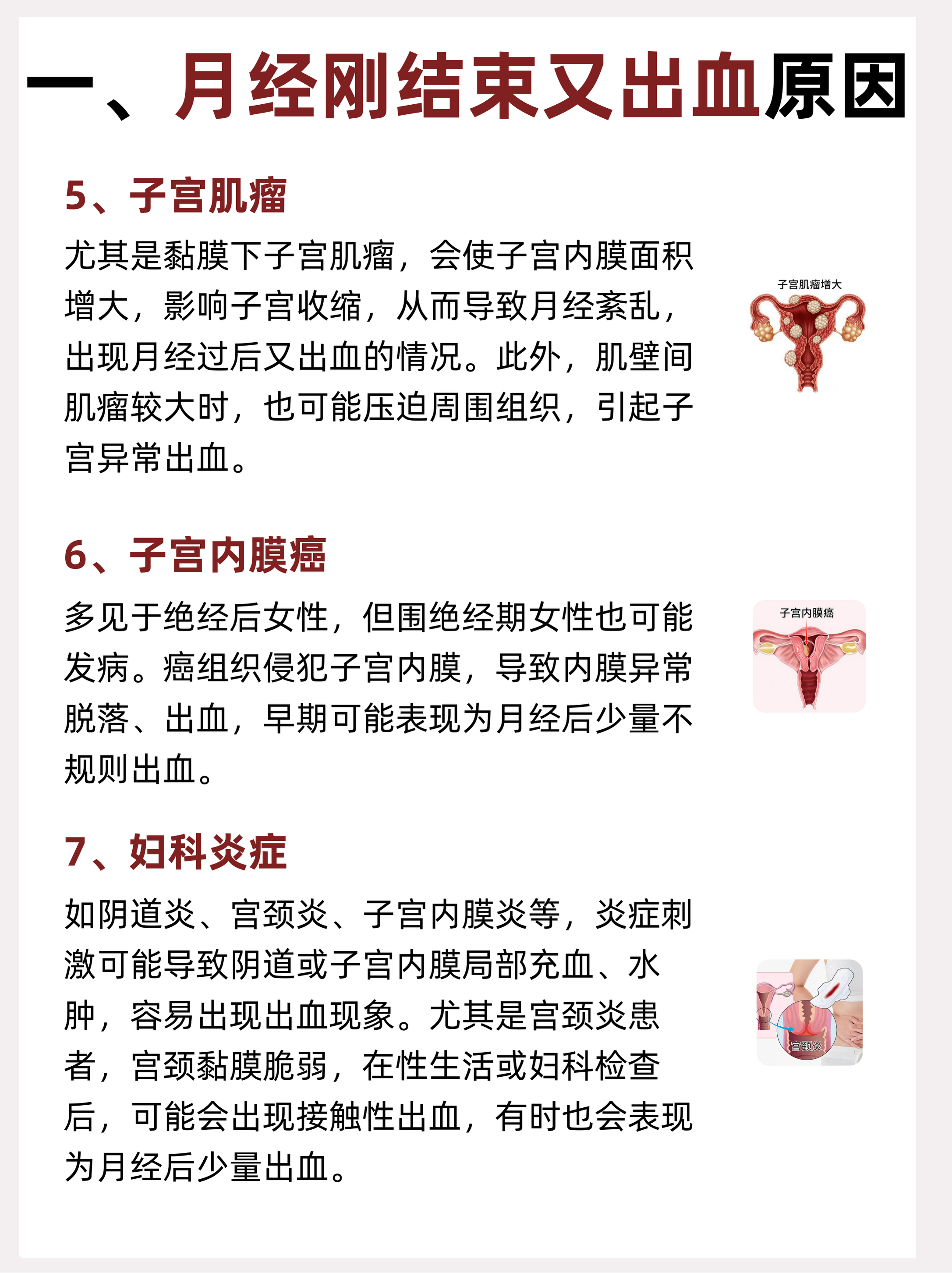 人流手术后出血一般多久?