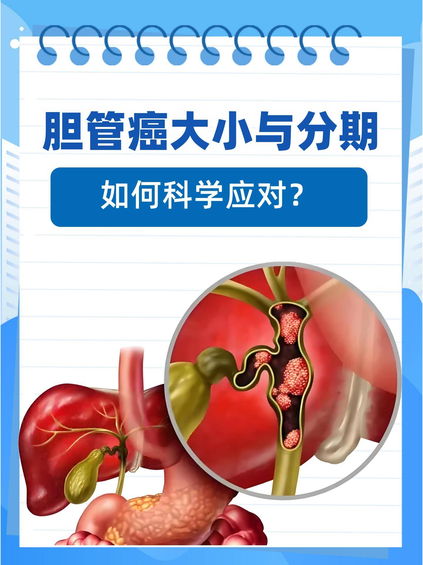 肝门部胆管癌能活多久