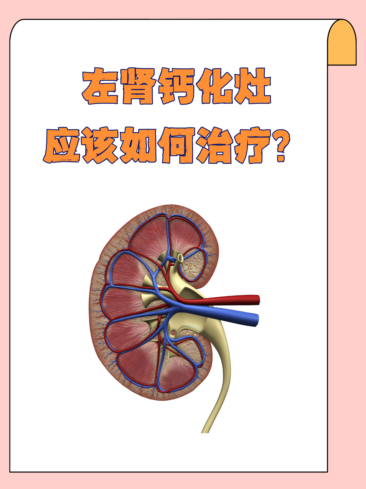 肝脏钙化灶需要治疗吗