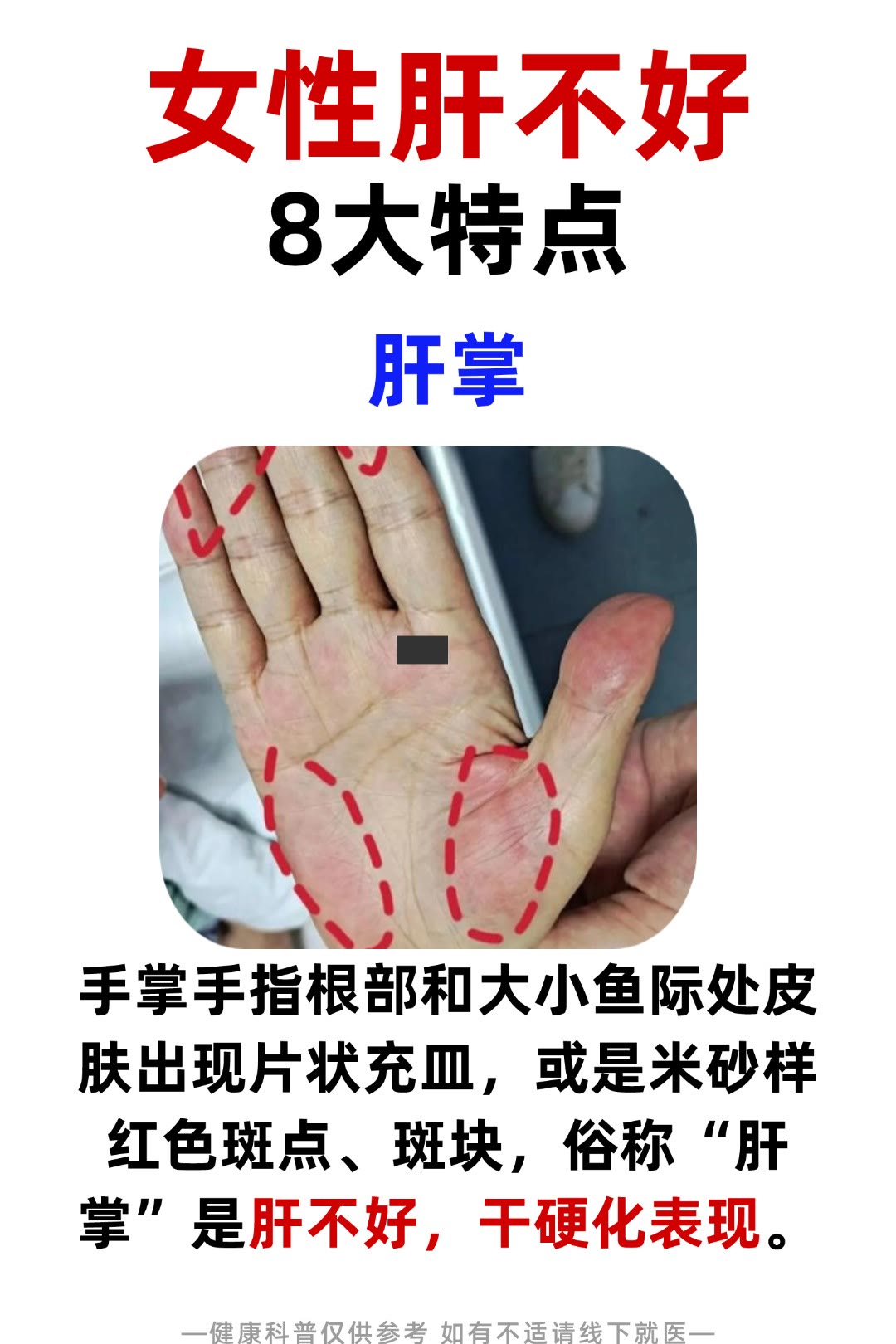 肾虚肝火旺的症状