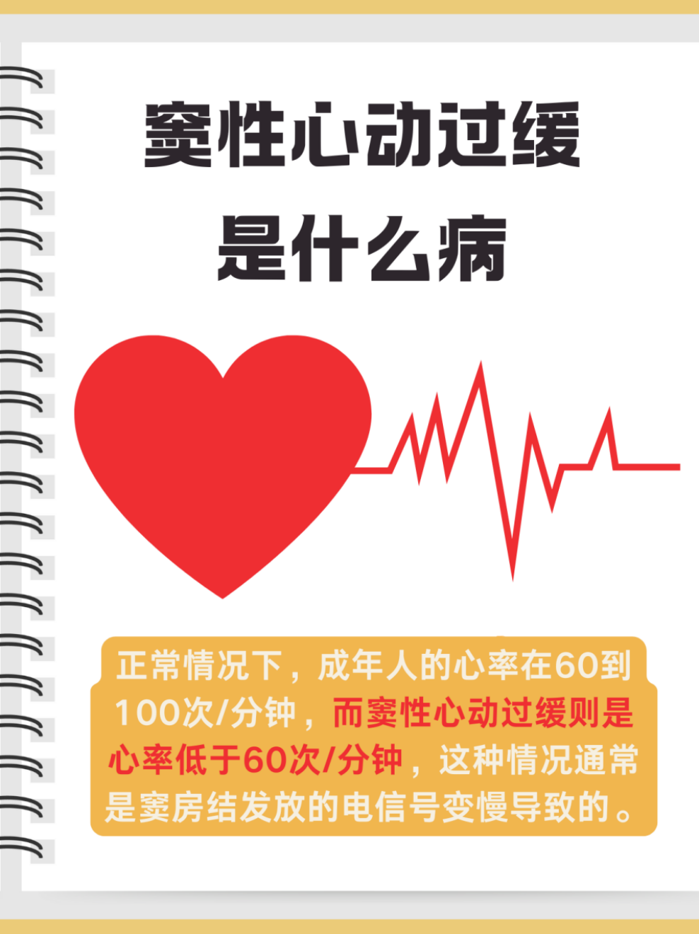 窦性心律是怎么回事