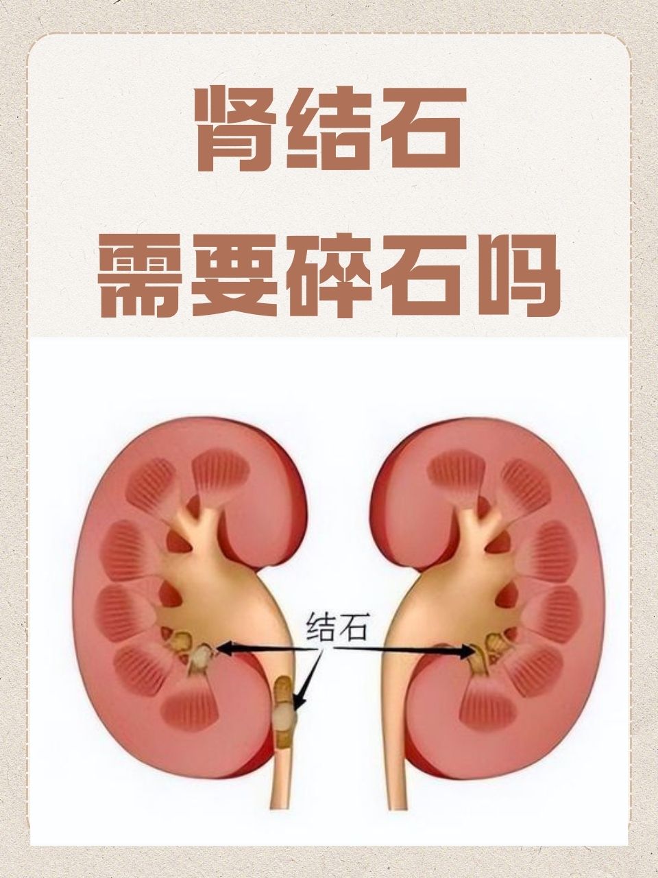 请问肾主骨是什么意思啊?