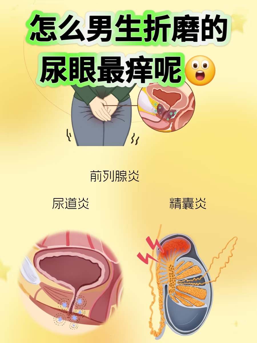 尿道瘙痒咋回事