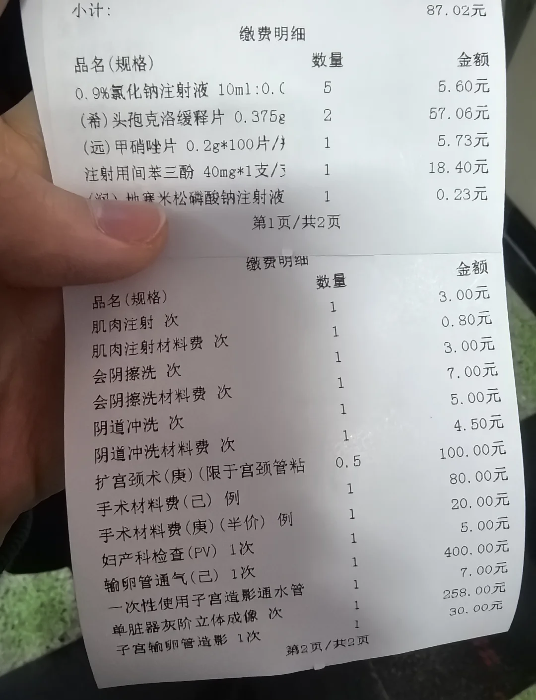 心脏造影如何收费,费用是多少.