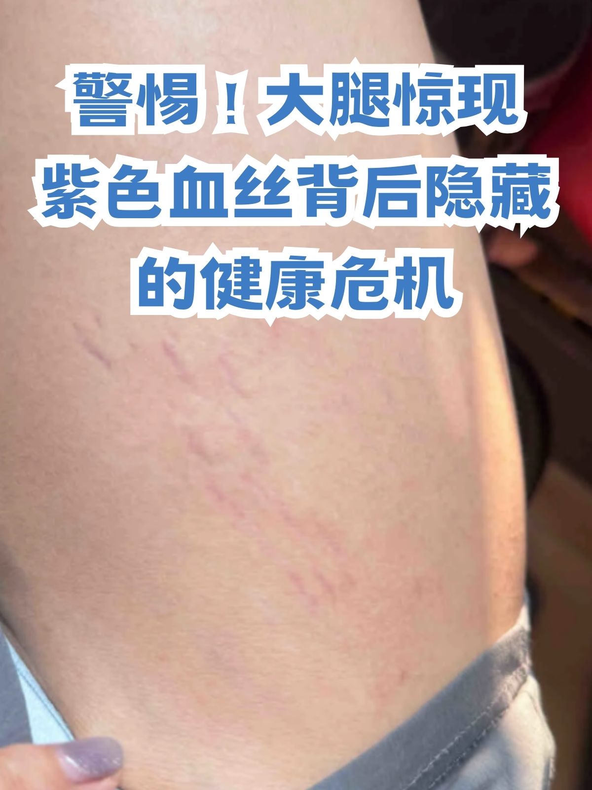 血象高会出现什么症状