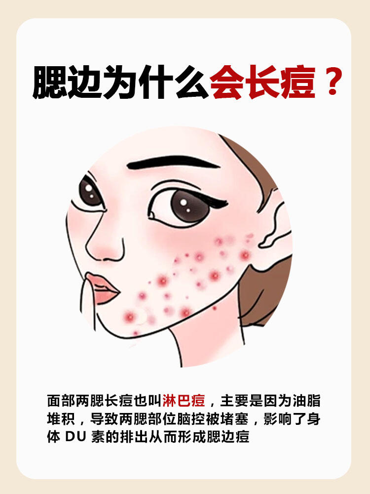 腮帮子两侧长痘什么原因