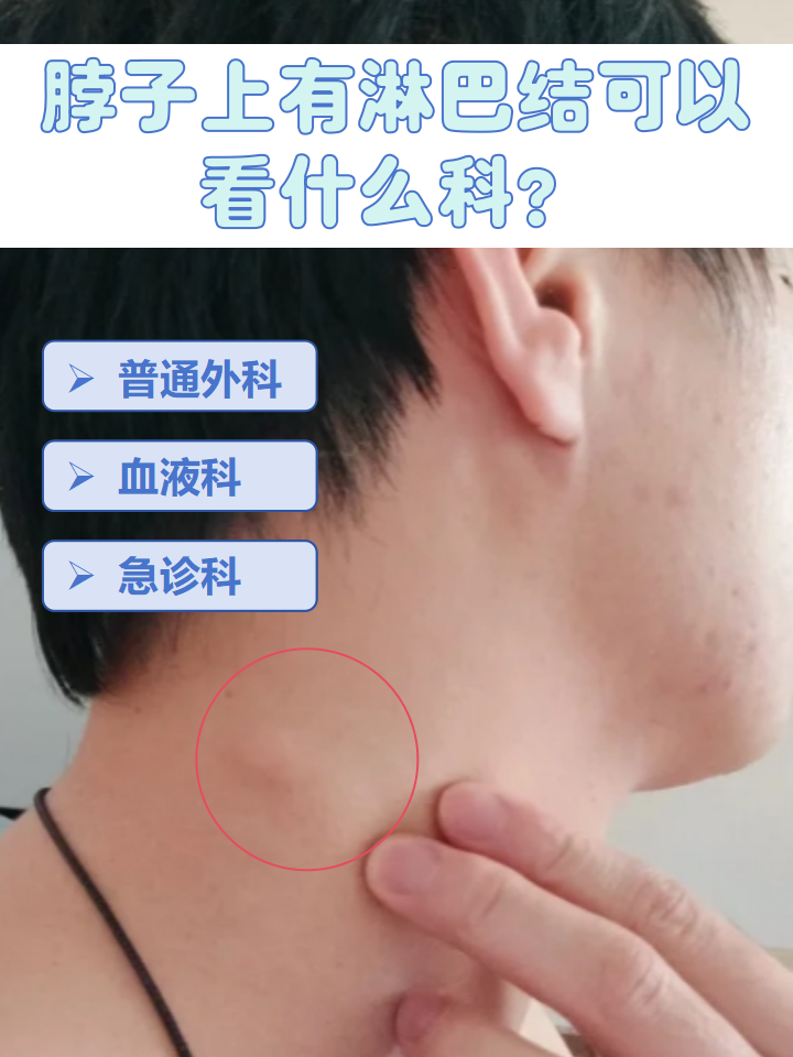 双侧颈部多发小淋巴结