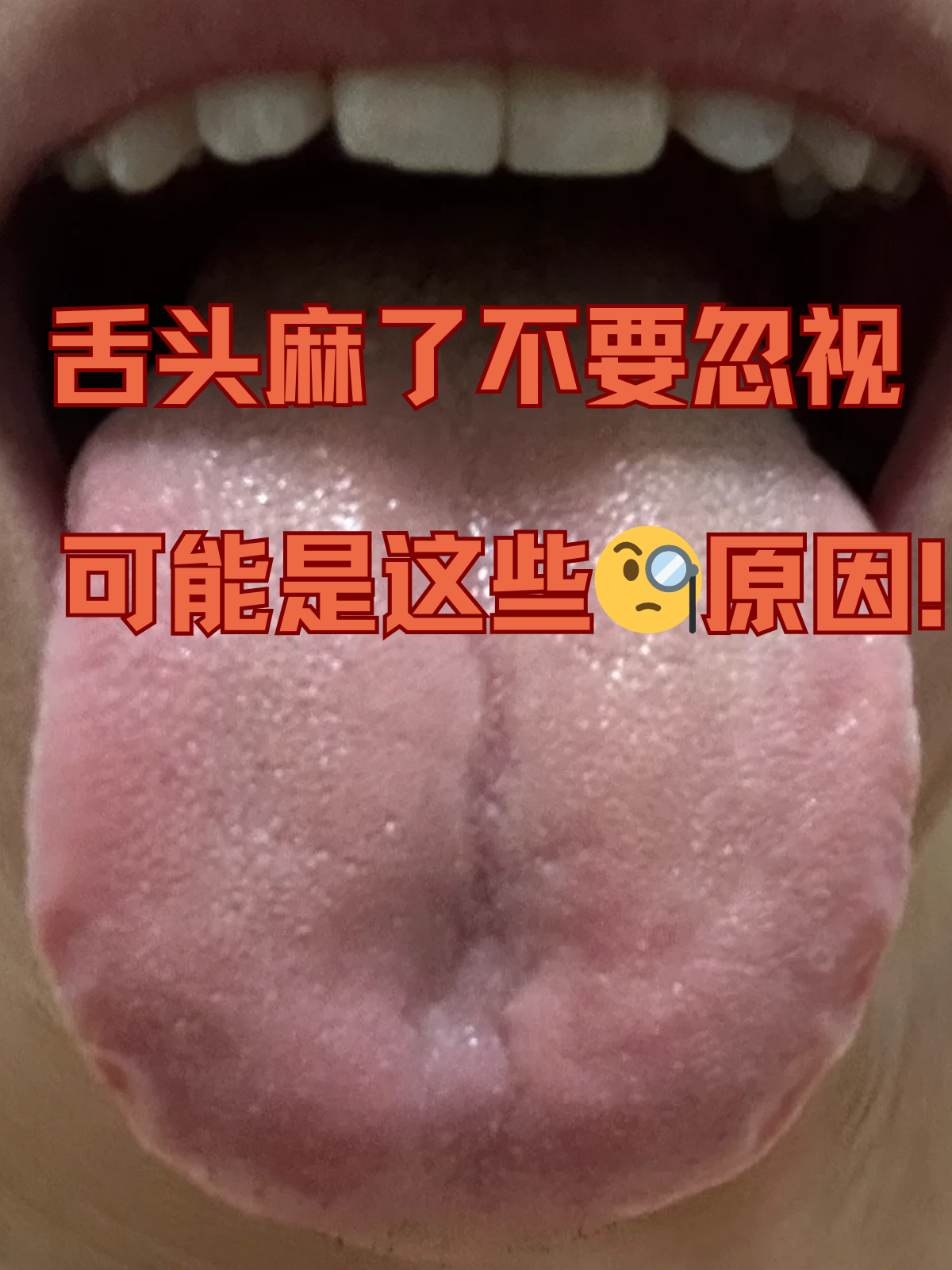 舌头总是发干是怎么回事?