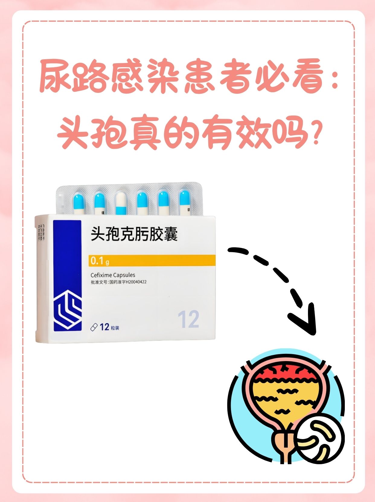 孕妇可以吃头孢消炎吗?