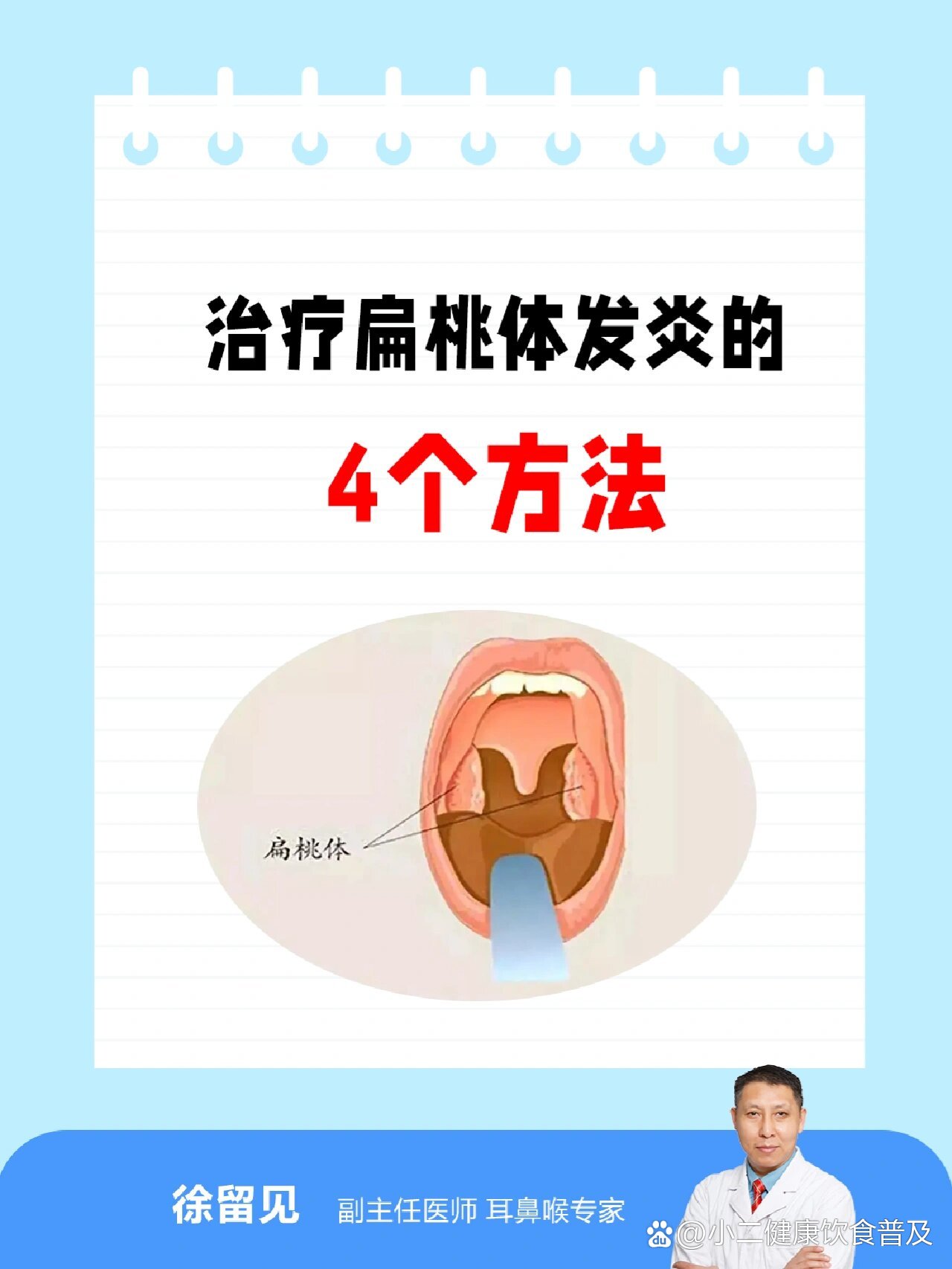 小儿扁桃体炎治疗