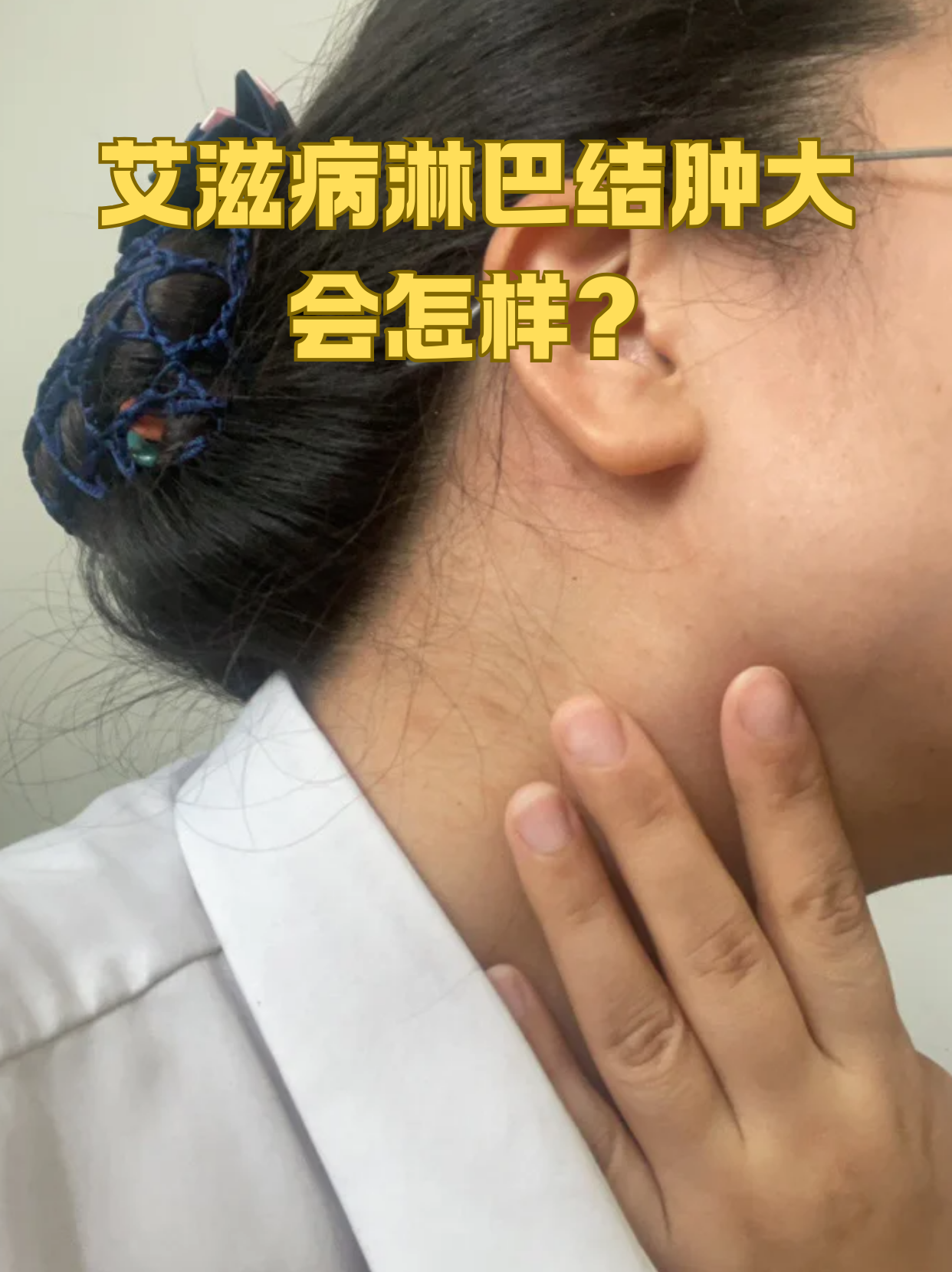 淋巴结早期都有什么症状