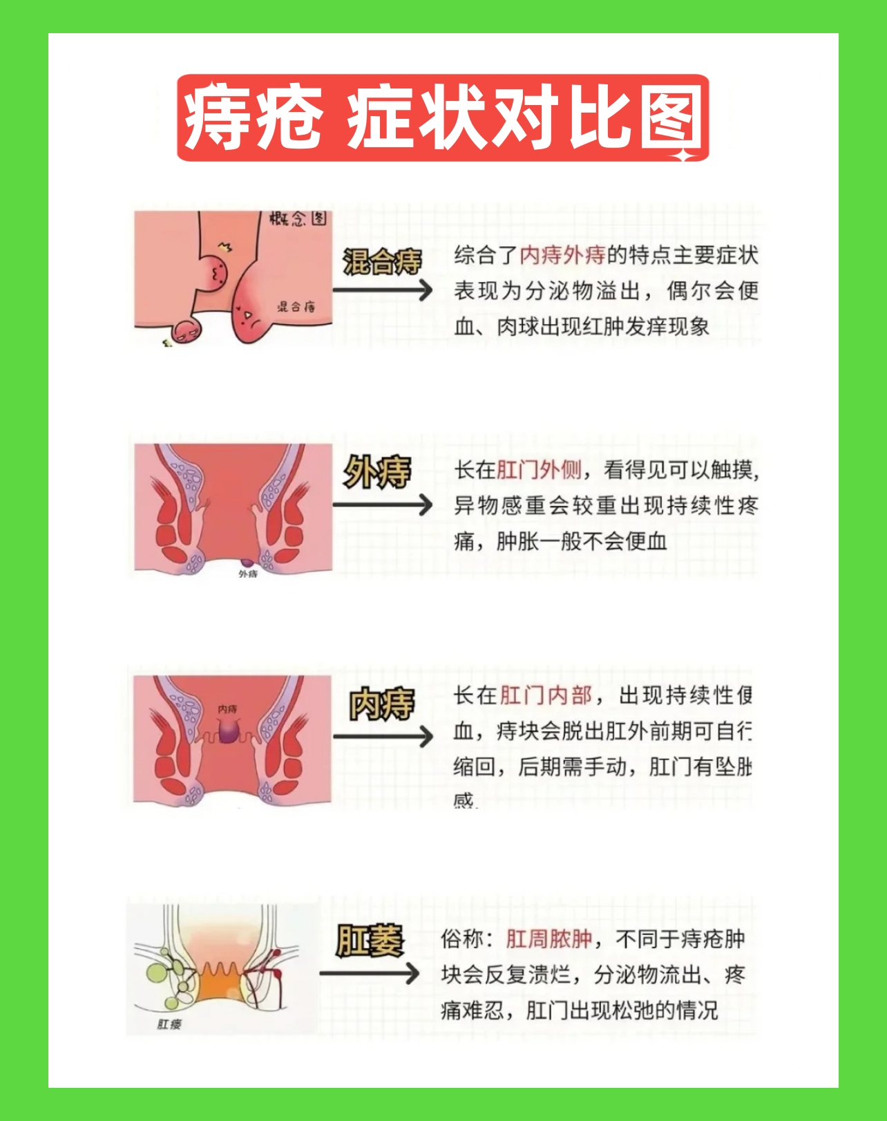 肛乳头瘤和痔疮的区别