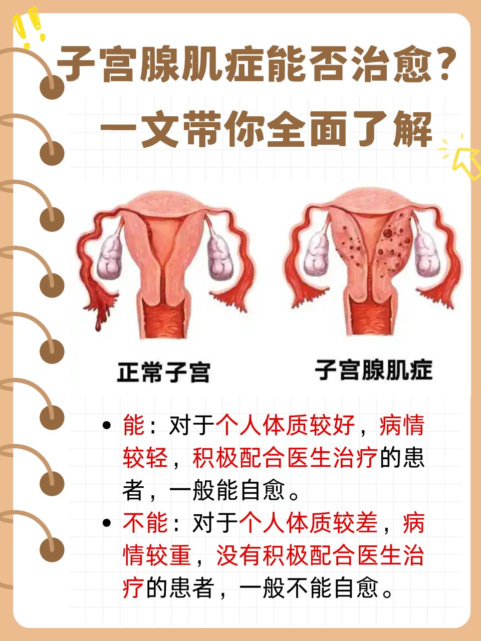 子宫腺肌症怎么治疗