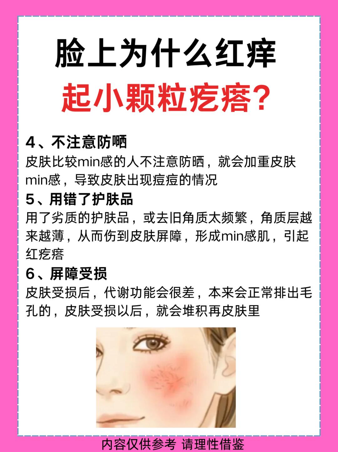 面部皮炎不能吃什么?