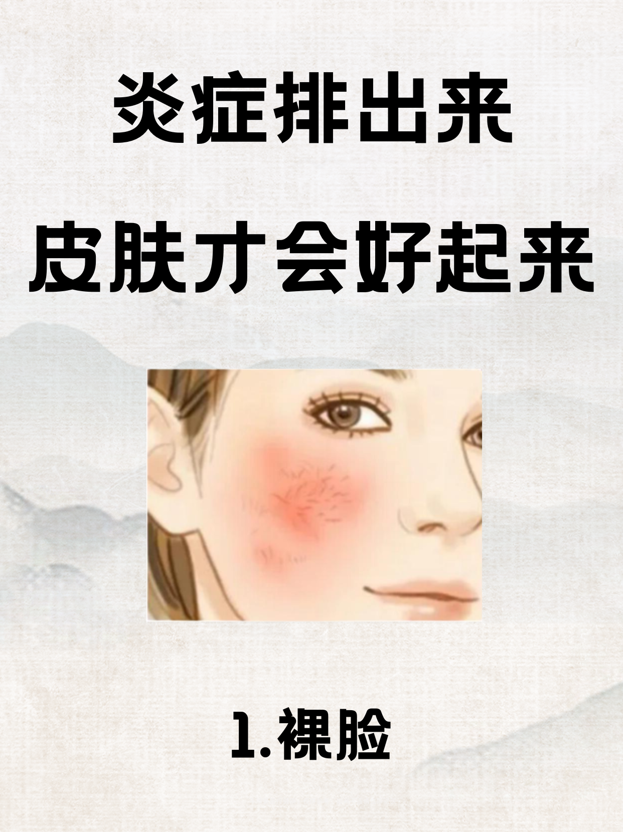 面部皮炎不能吃什么?