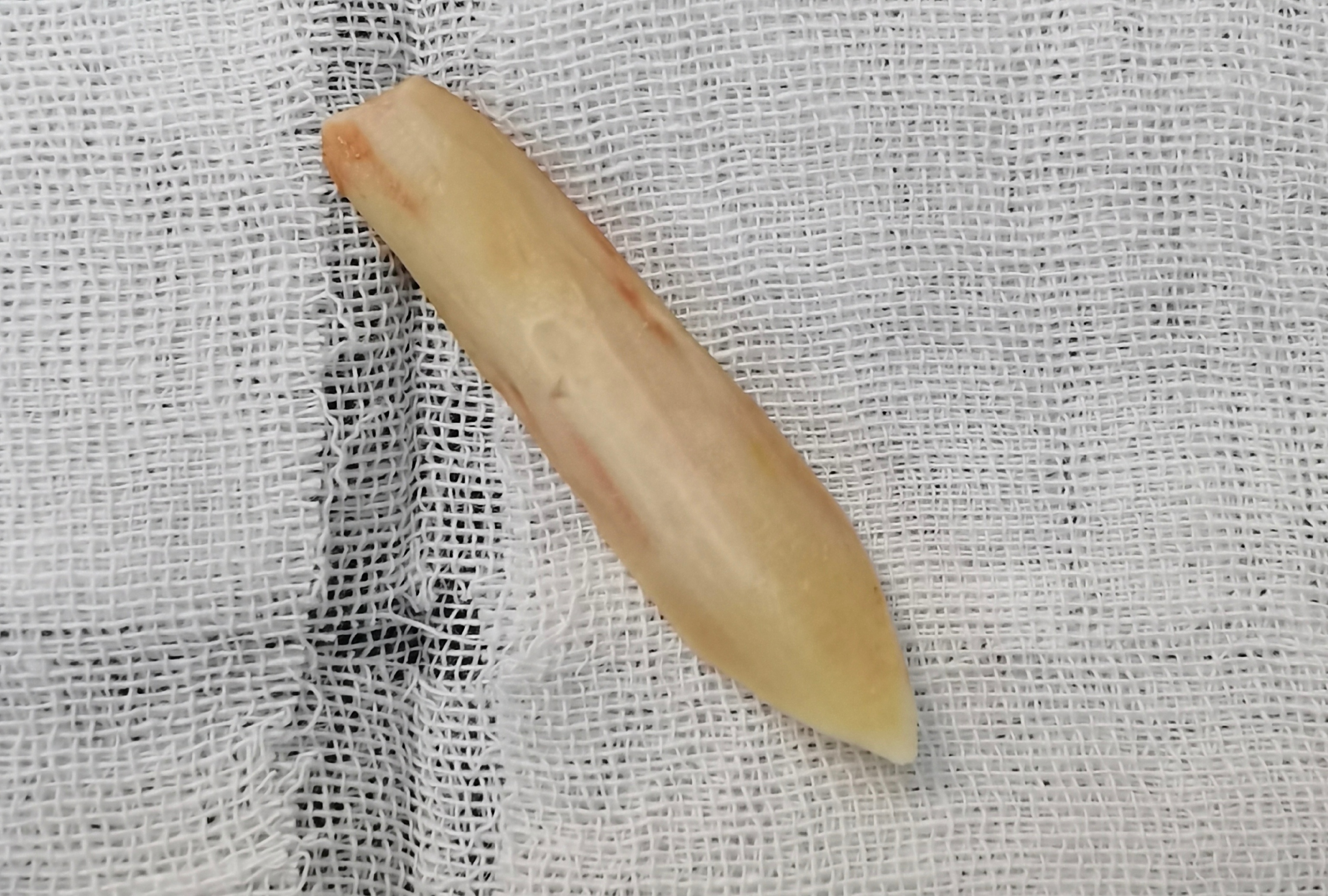 请问隆鼻的假体什么样的最好?用不用换?