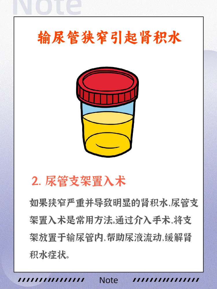 输尿管狭窄导致肾积水