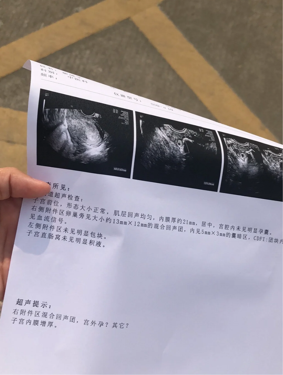 吃避孕药几天后出血了