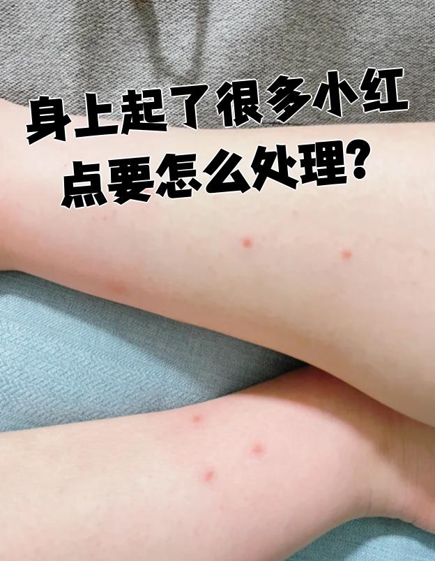 身上有小红点是怎么回事?