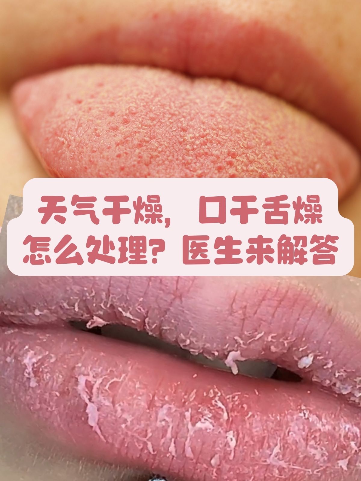 口干舌燥怎么办?