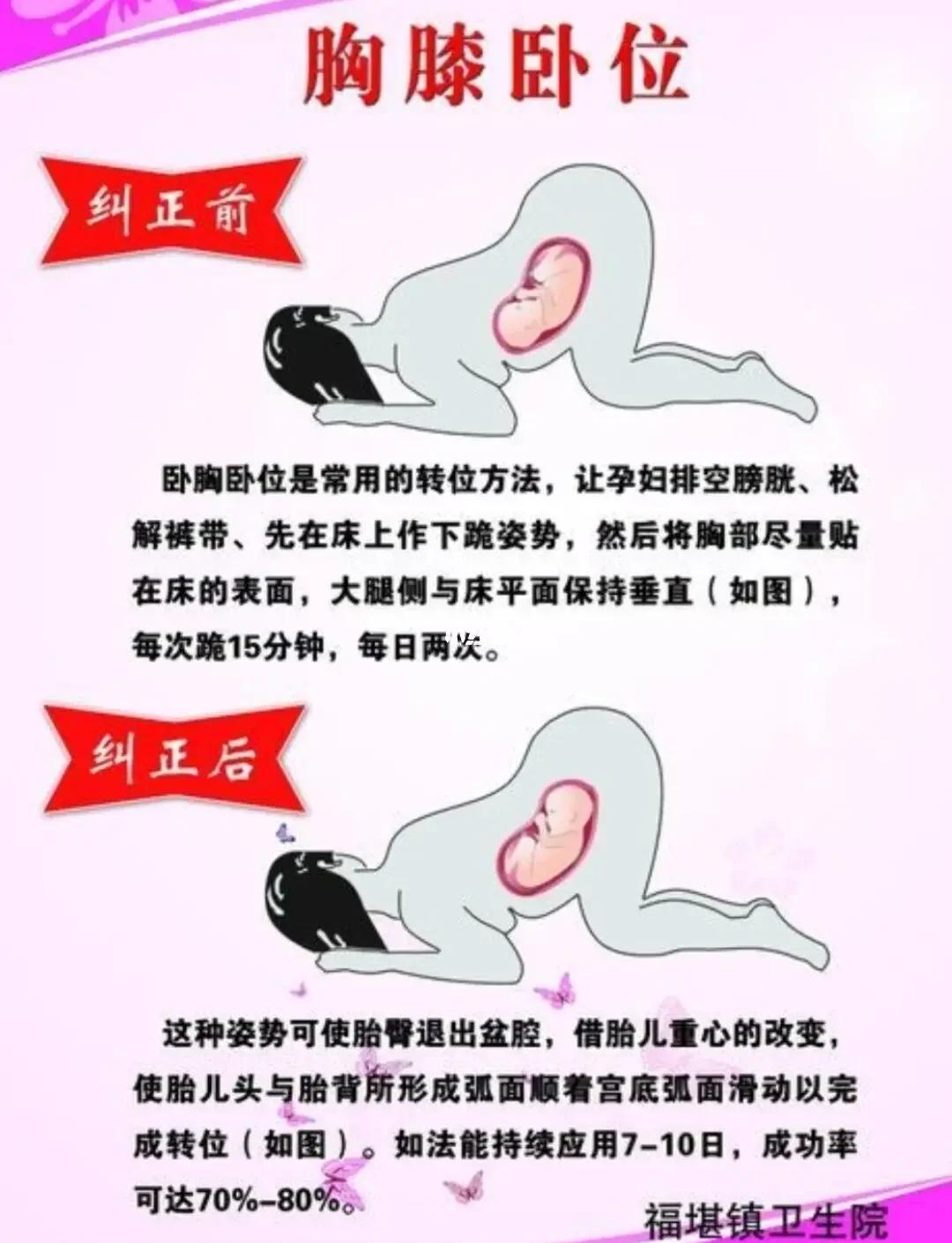 怎么样才能怀上双胞胎?