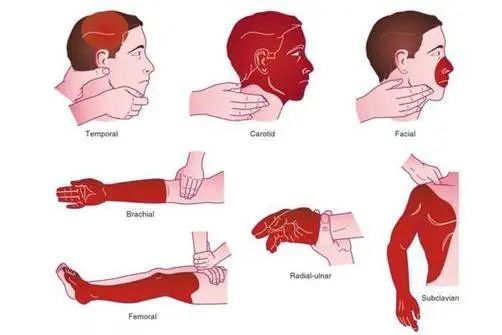 常用的止血方法有哪几类?