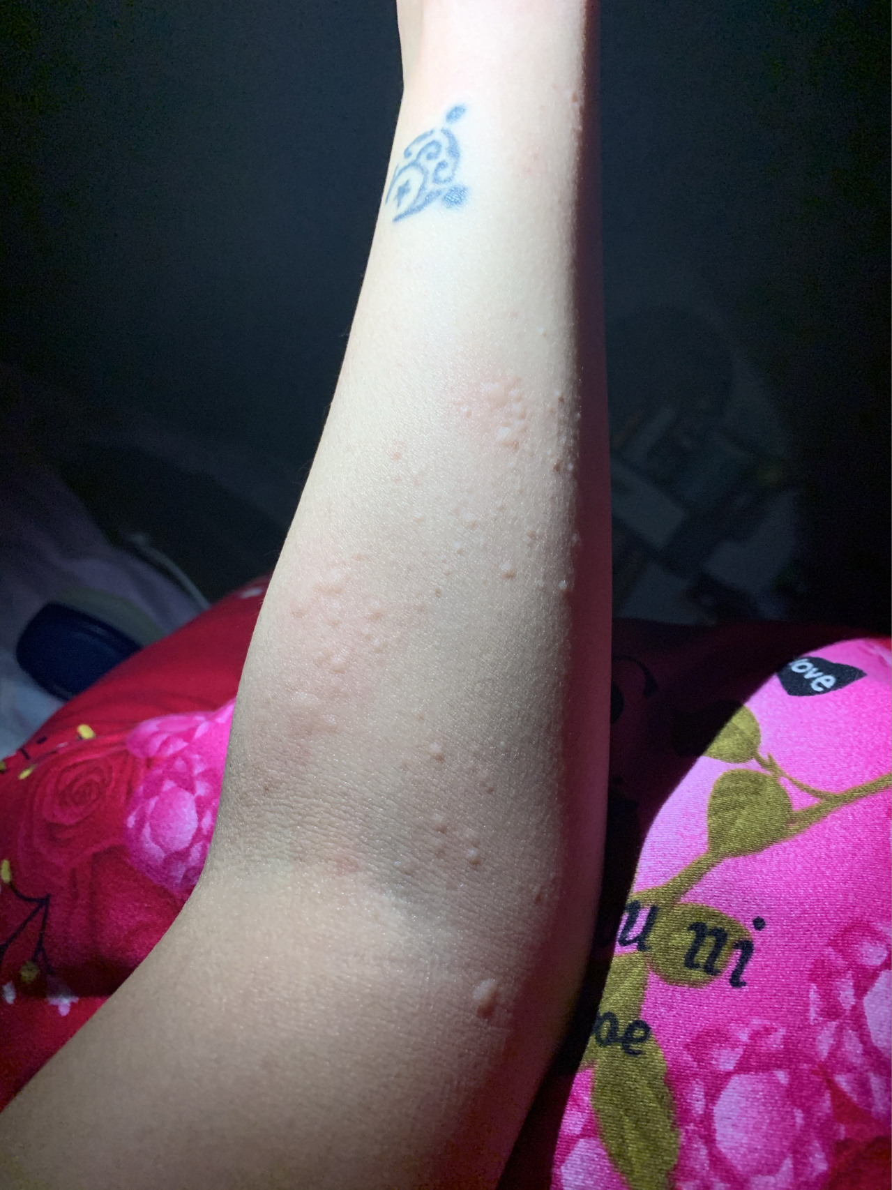 皮肤长小疙瘩很痒