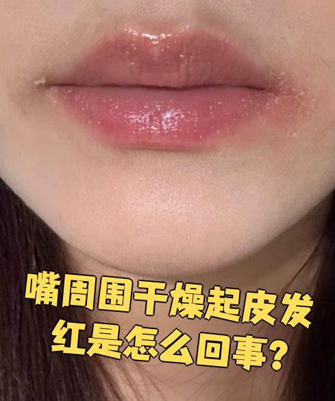 嘴巴干什么原因?