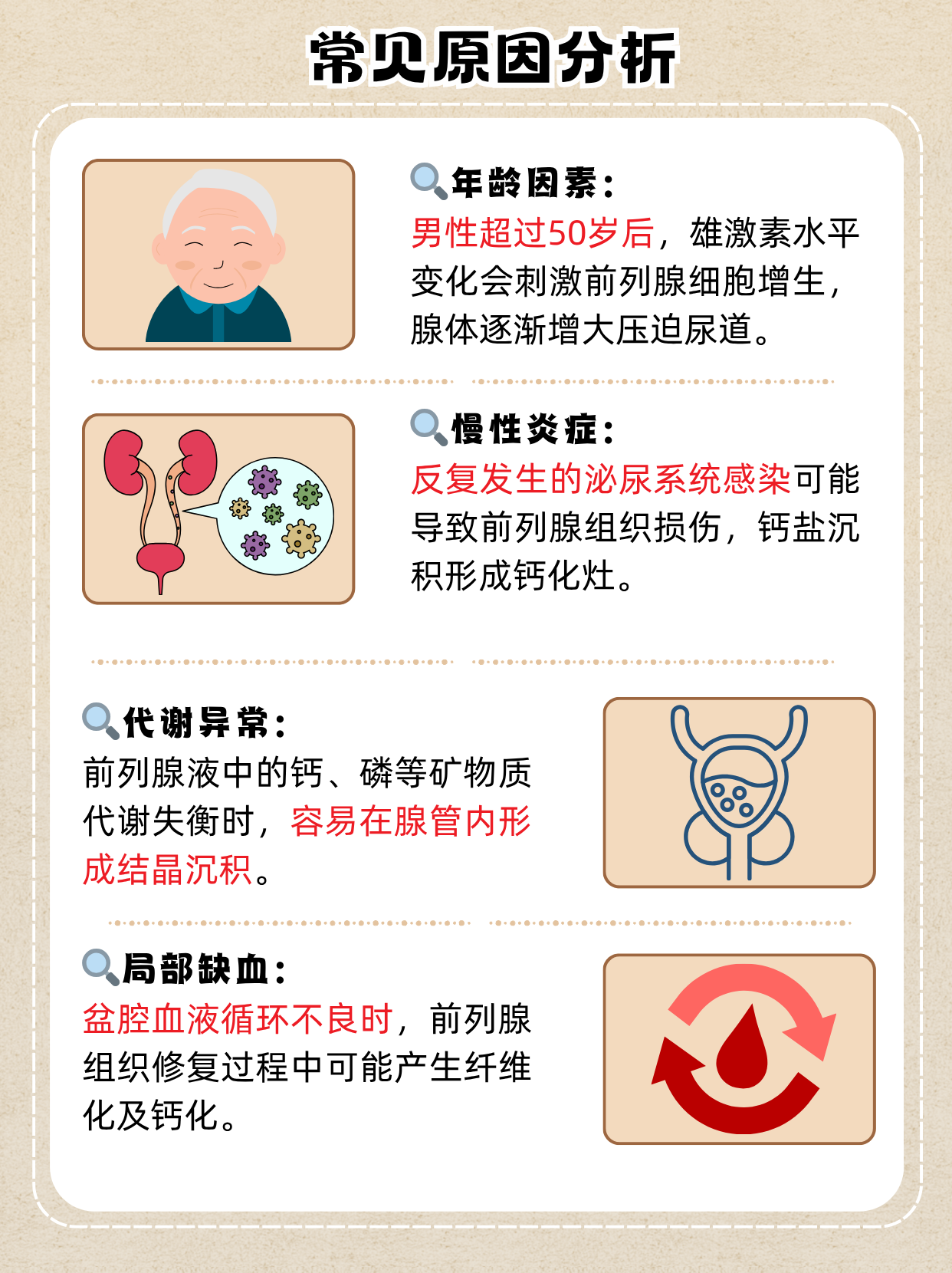 前列腺增大伴钙化是什么意思?