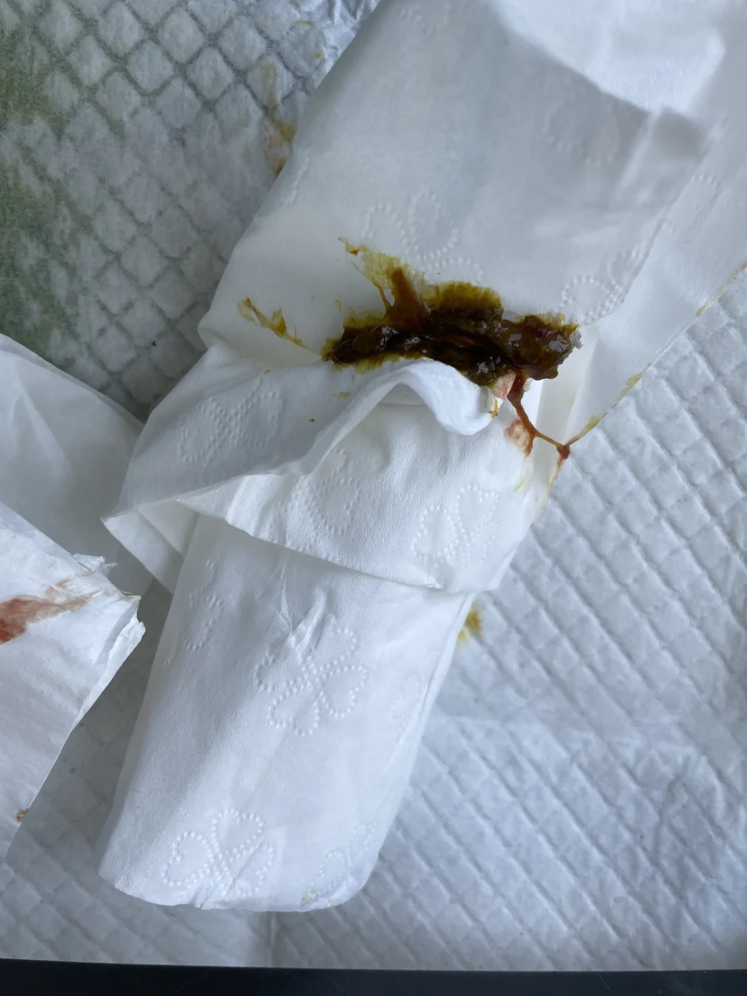 大便出血鲜红不痛