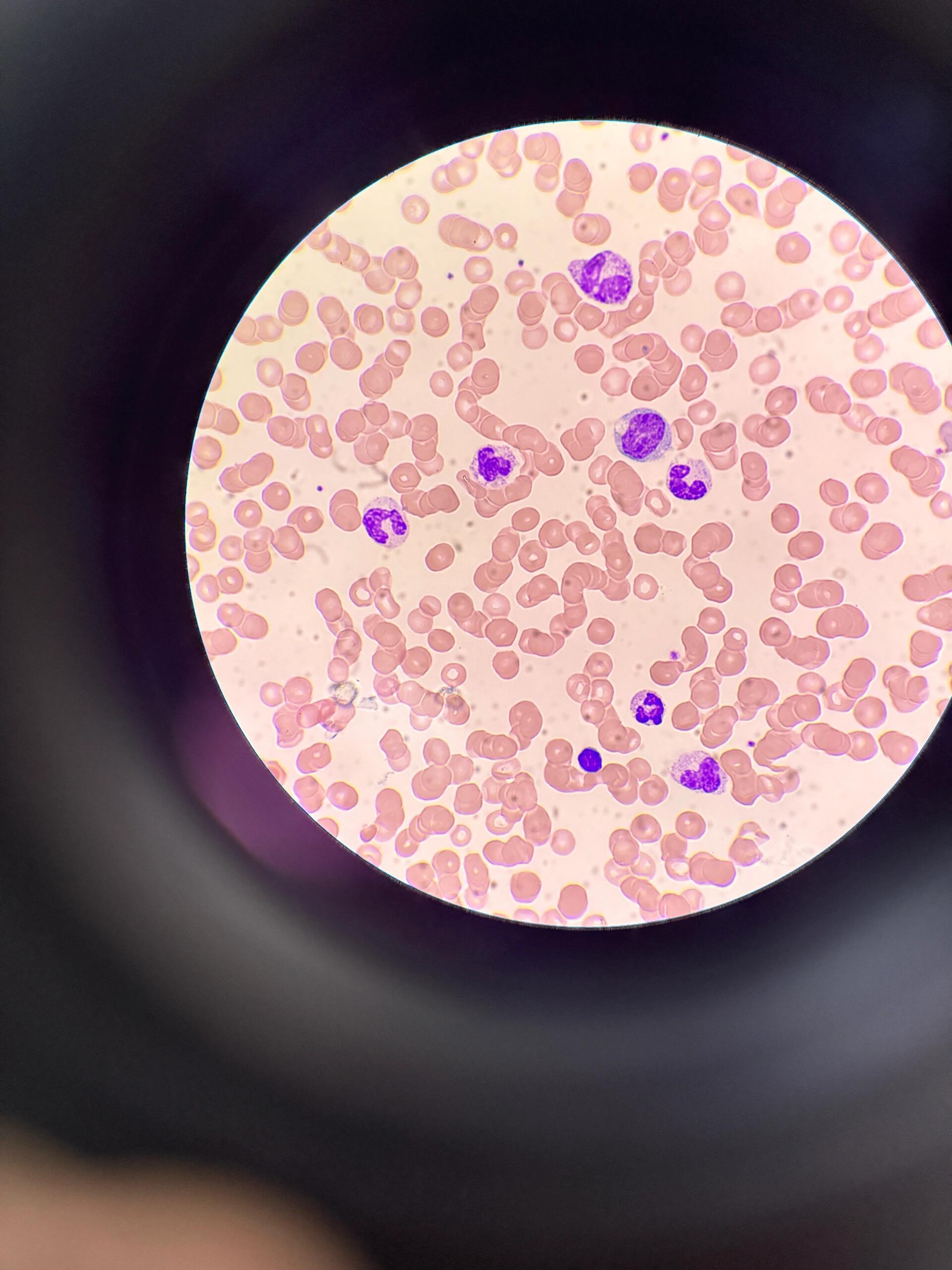 中性粒细胞百分比偏低