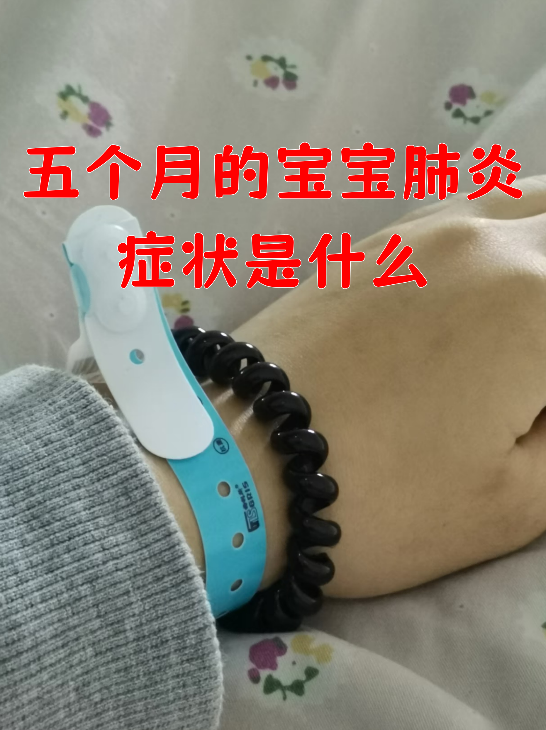 婴儿肺炎的早期症状有哪些