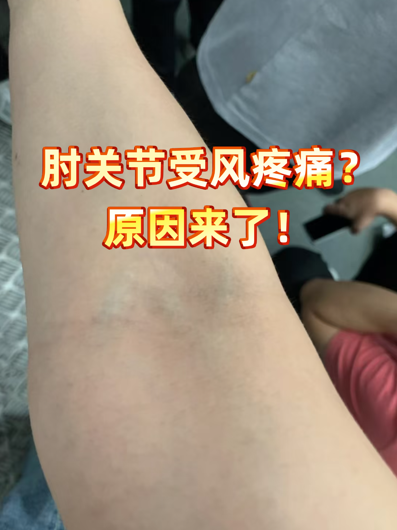 胳膊肘疼,是为什么?