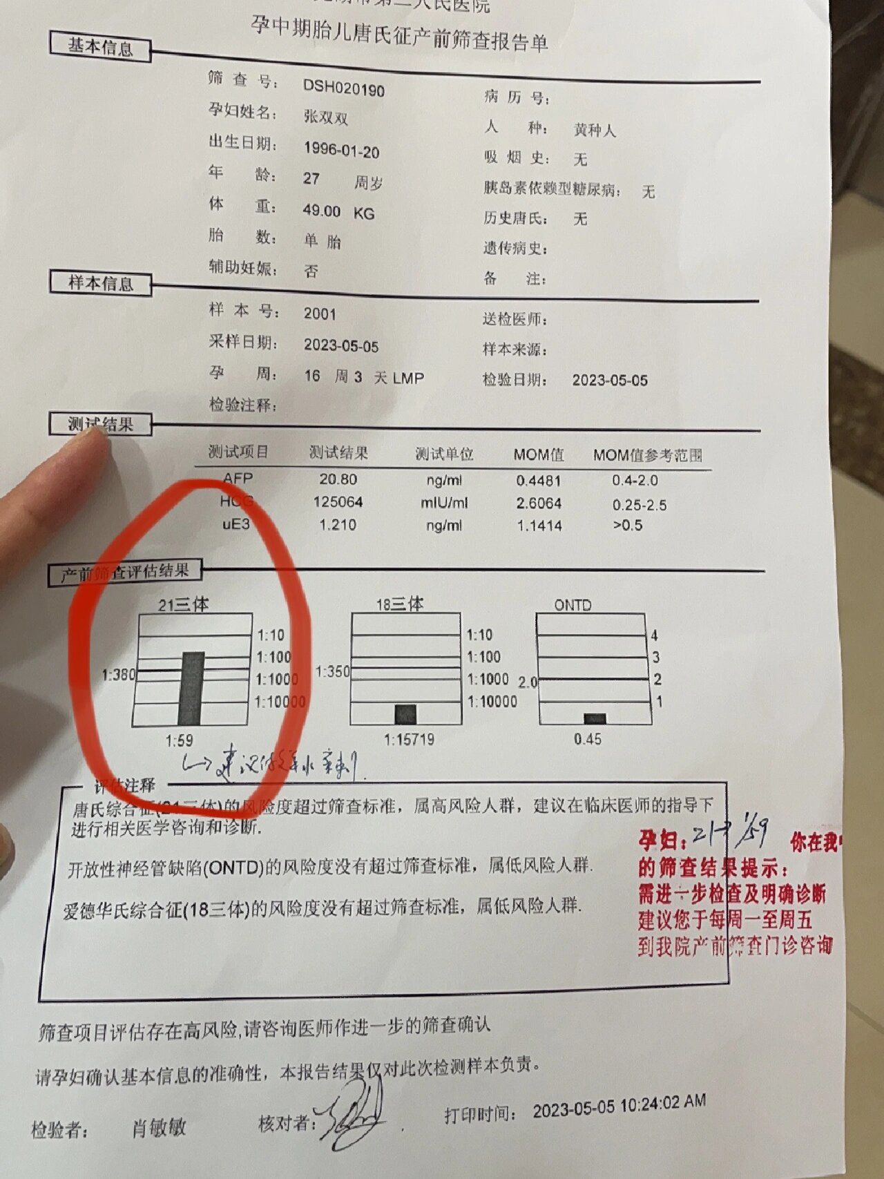 唐氏筛查会检查哪些项目?