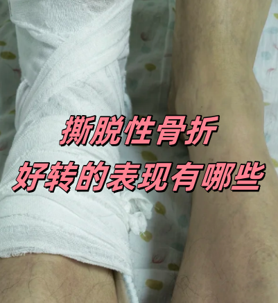 脚背撕脱性骨折多久能走路