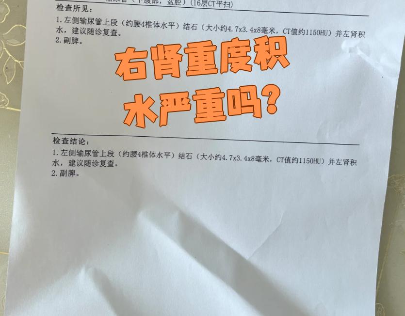 肾积水,严重吗?怎么办?