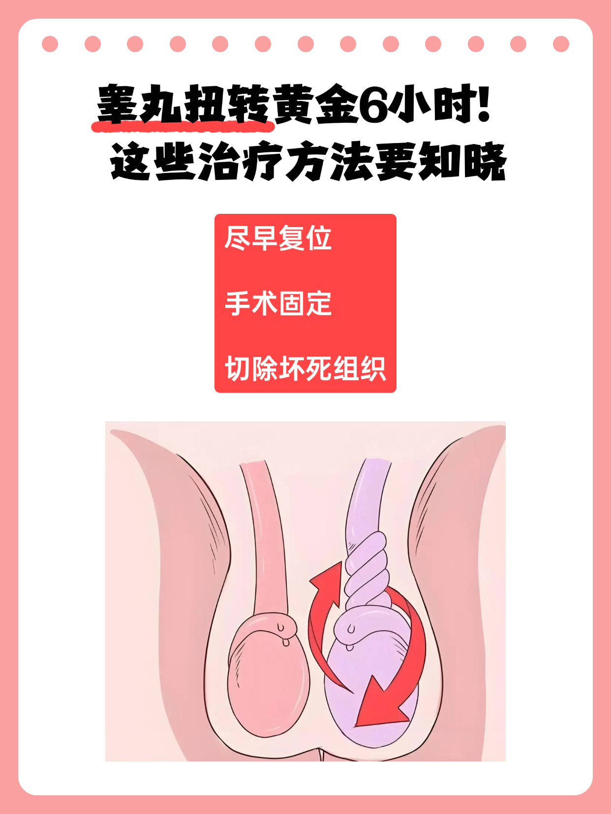 睾丸在扭转怎么回事