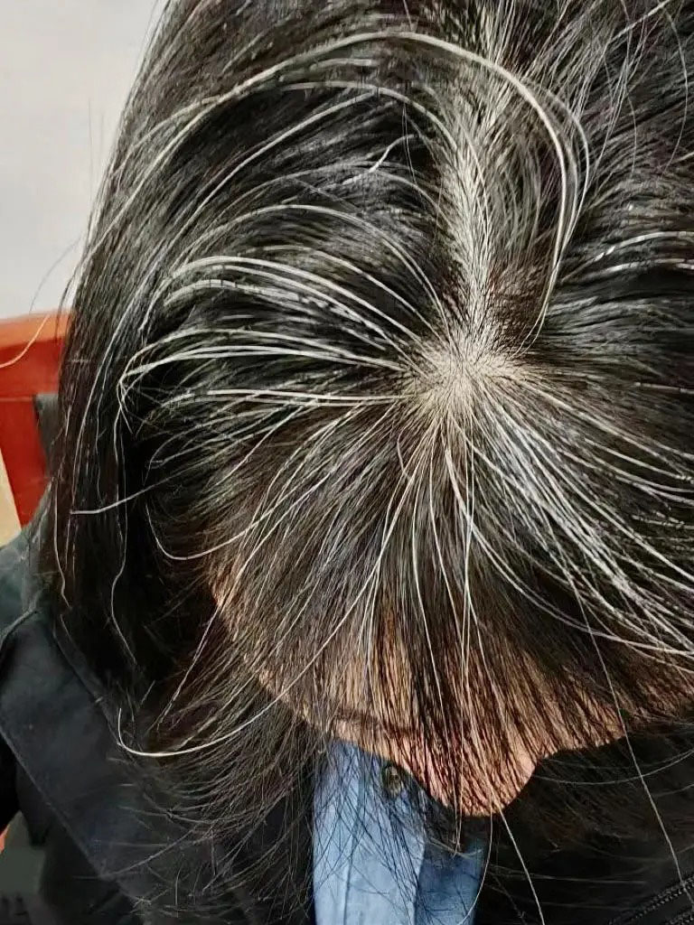 没有不舒服,染发染得不好第二天可以在染吗