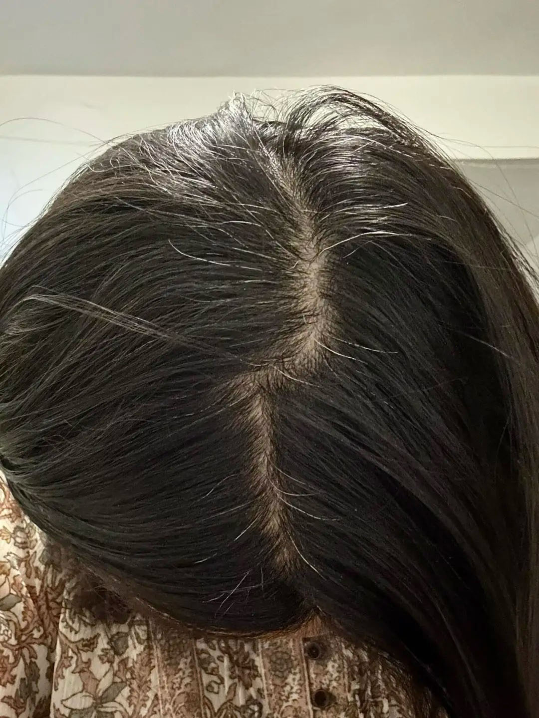 没有不舒服,染发染得不好第二天可以在染吗