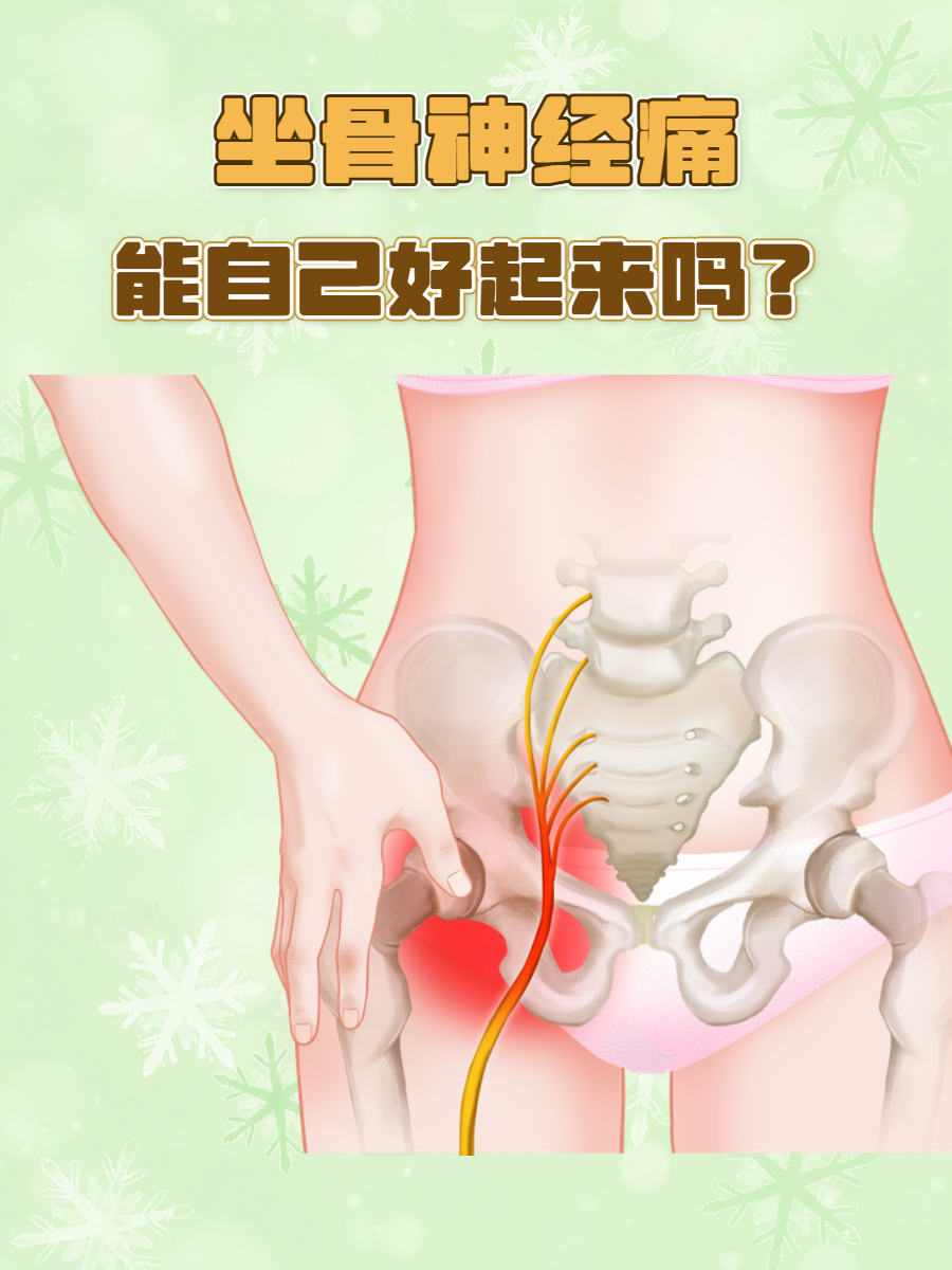 坐骨神经痛的原因是什么?