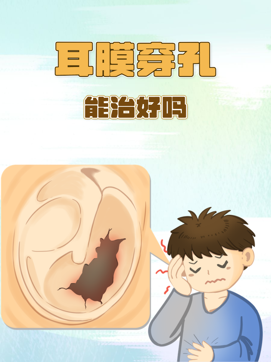 耳膜穿孔一般多久自愈