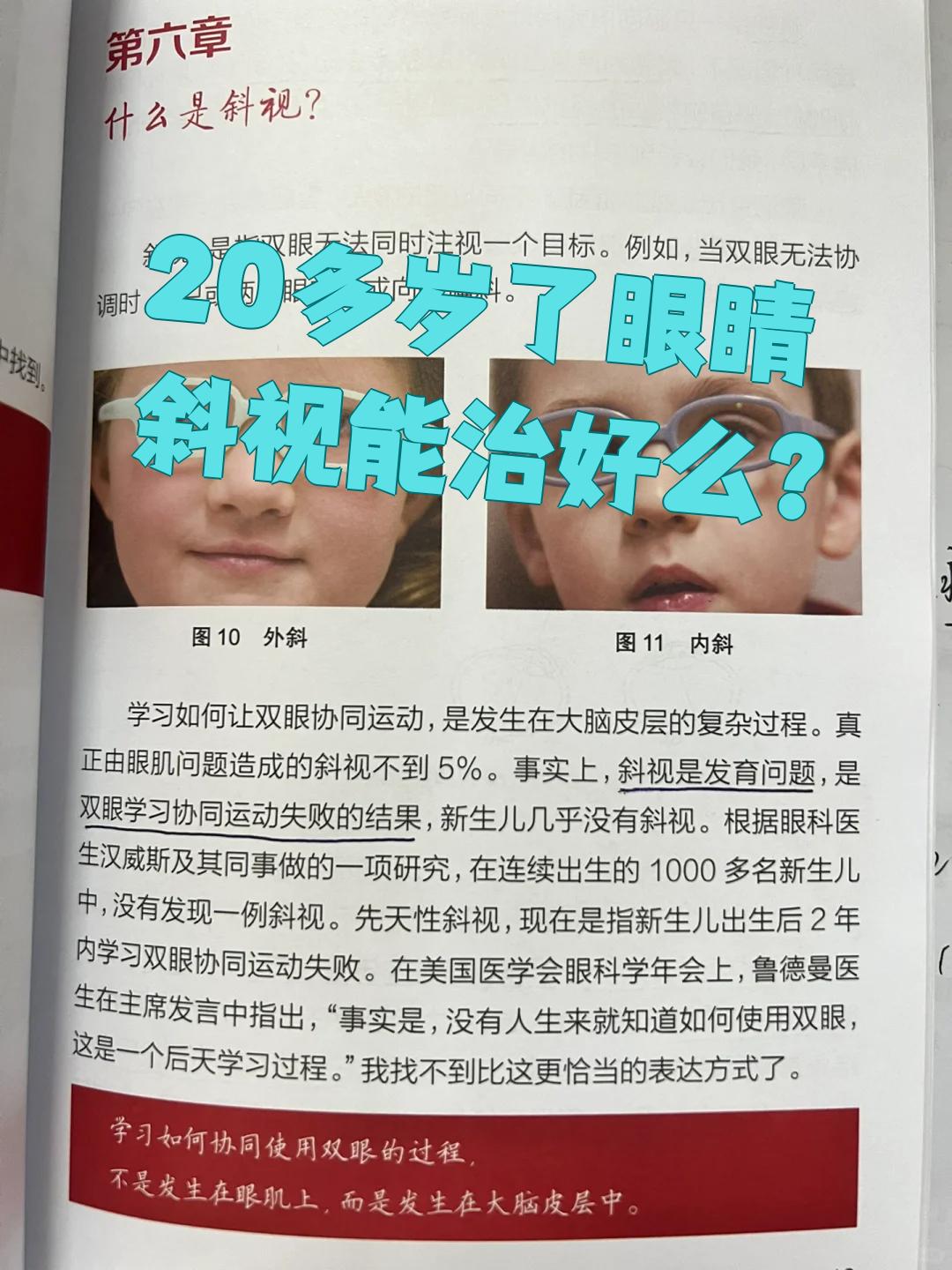 斜视必须要做手术吗?