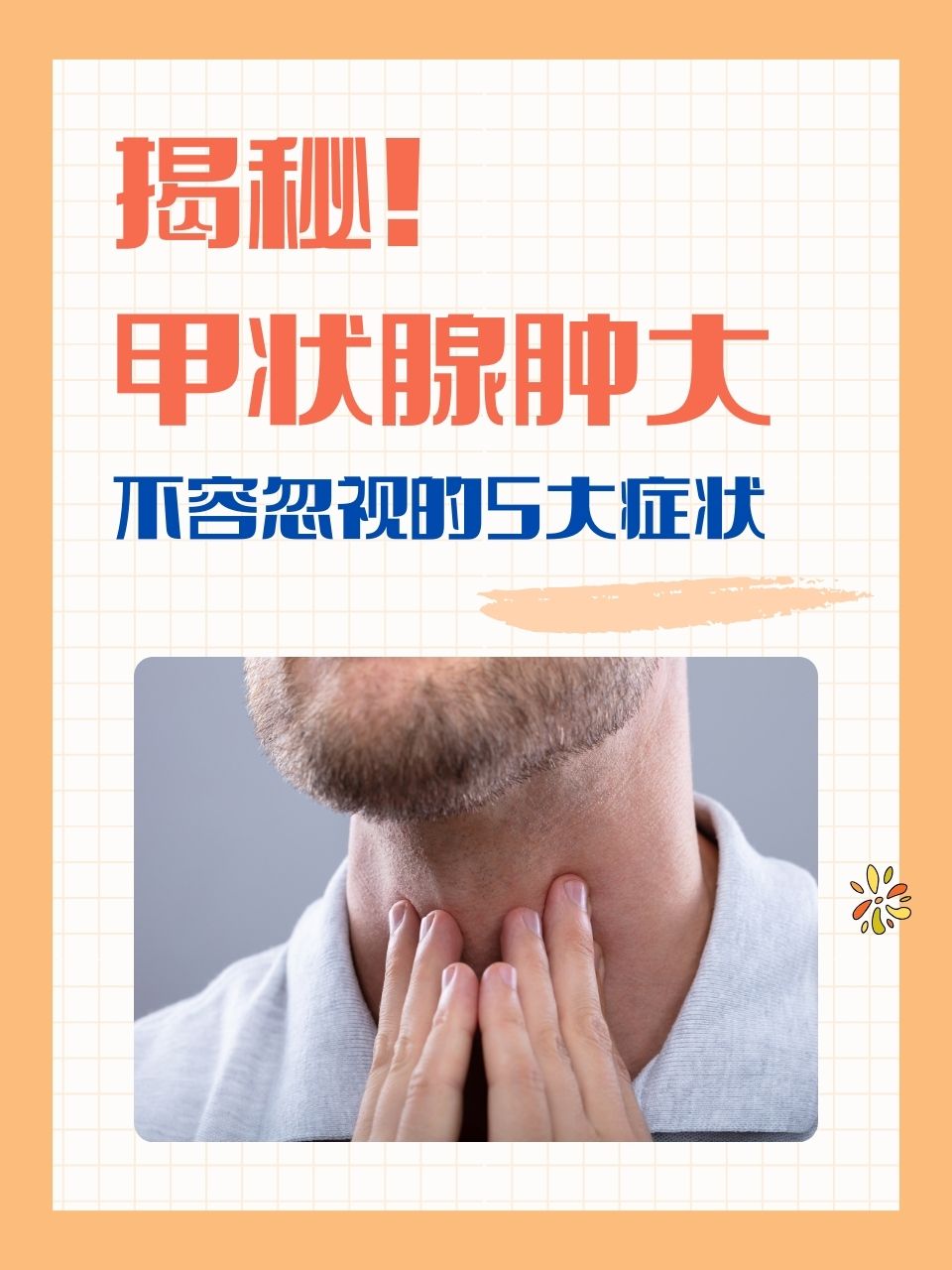 甲状腺肿大的症状有哪些?