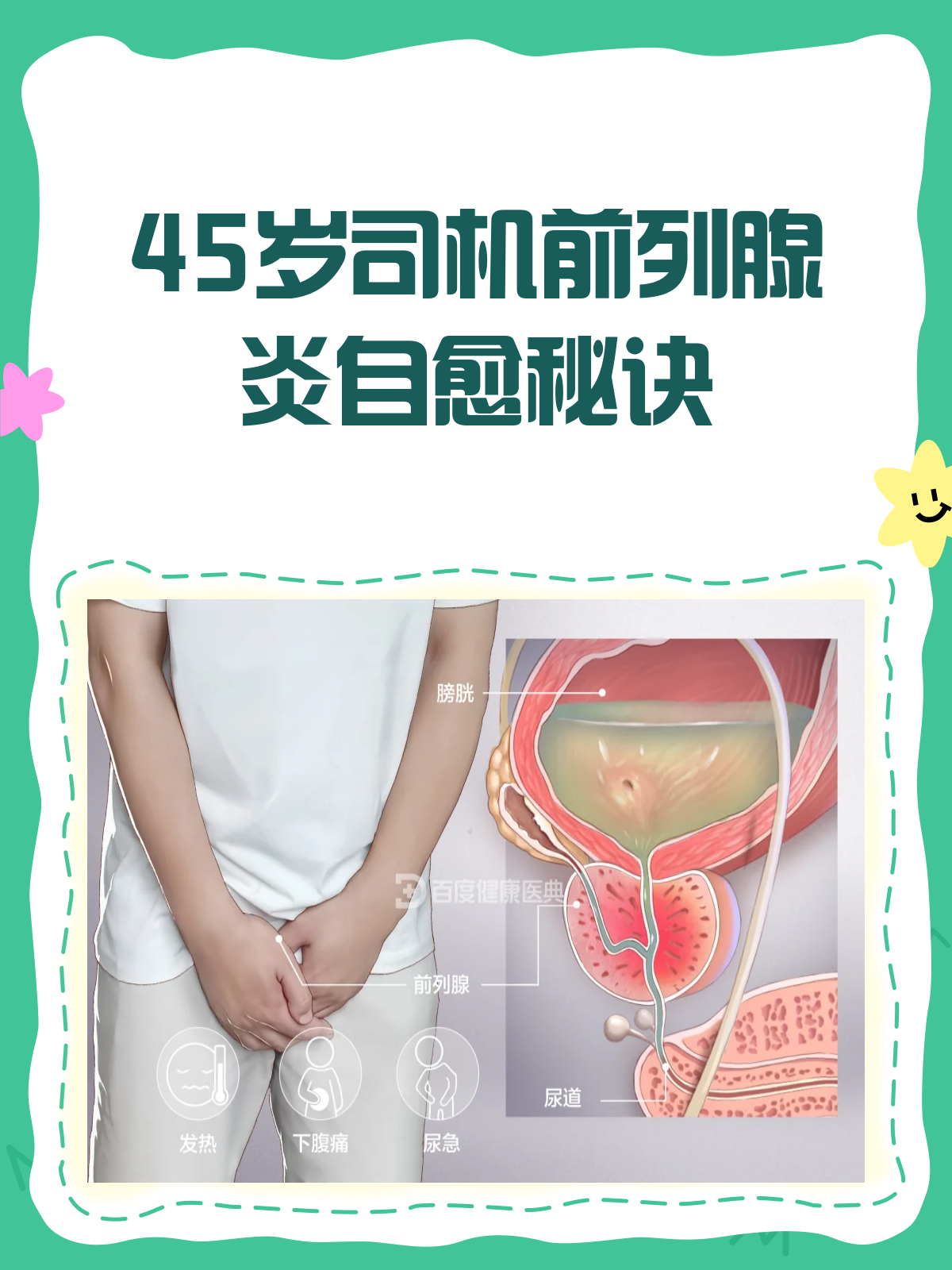 前列腺炎能彻底治愈吗