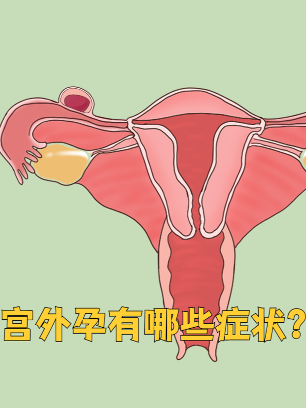 女性怀孕初期的症状