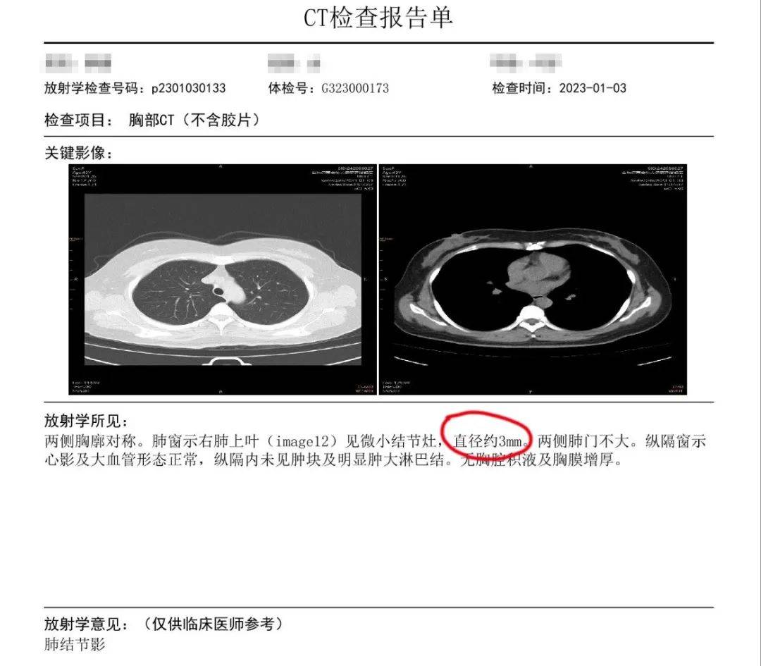3mm肺部结节有危险吗