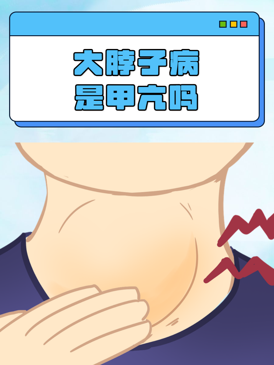 脖子粗就是甲亢吗?