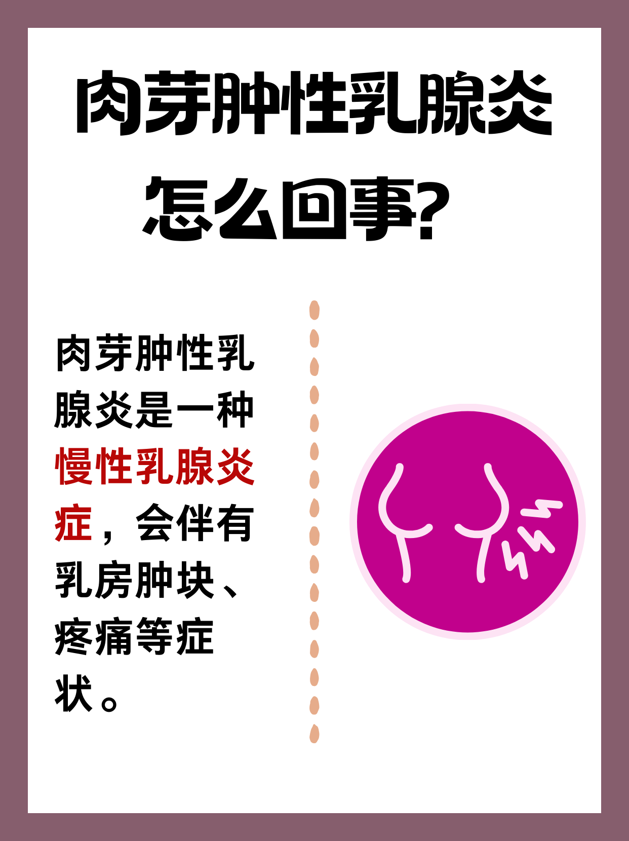 乳腺炎的症状和治疗