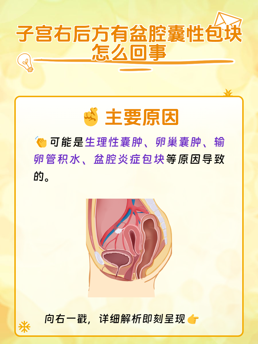 盆腔囊肿严重吗....